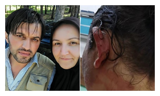 Çocuklarının Gözü Önünde: Eşini Kızgın Su ve Yağ ile Yaktı