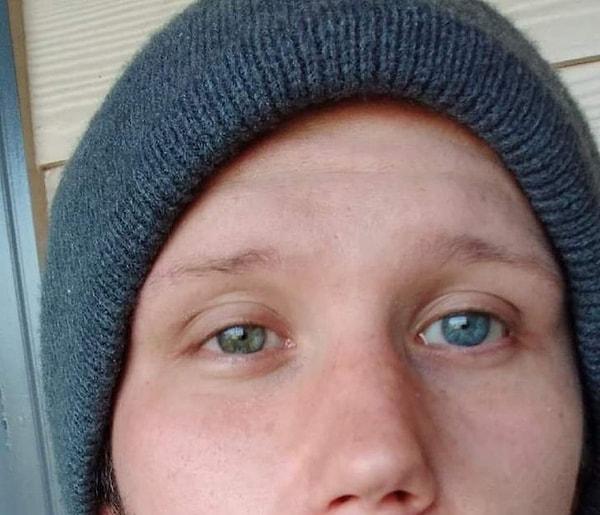 9. "Herkese merhaba, ben heterokromi ile doğdum. Bu fotoğrafta sol gözüm mavi, sağ gözüm yeşil. Toplumun bir parçası olduğum için çok mutluyum!”