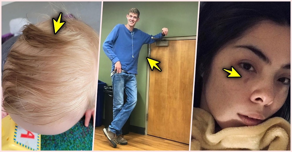 Sahip Oldukları Eşsiz Özelliklerle Farklı Olmanın Aslında Ne Kadar Özel Olduğunu Gösteren 19 Kişi