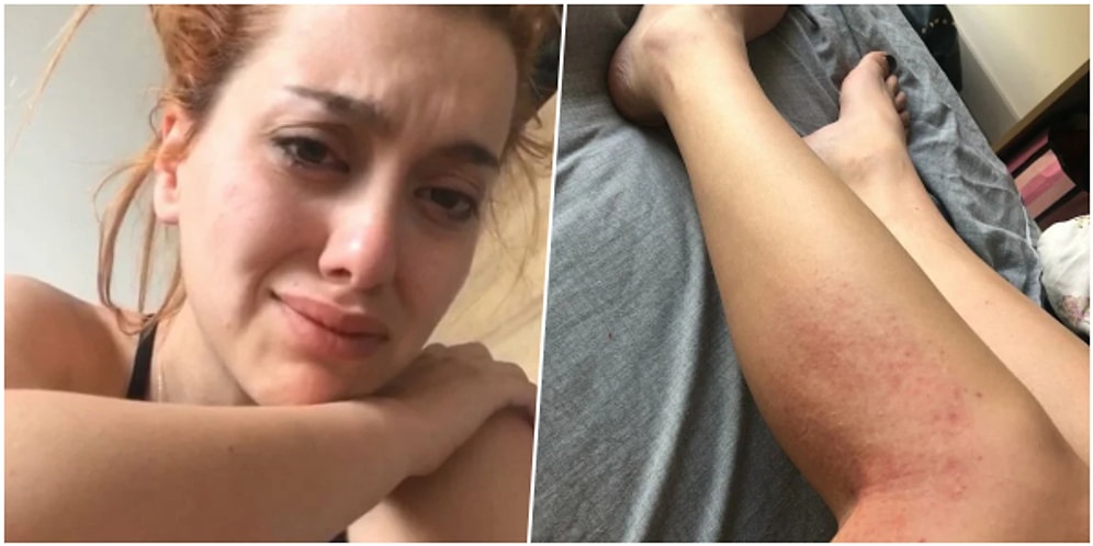 Topuklu Ayakkabı Giydi, Kabusu Yaşadı: 'Korkuyorum Ne Olur Yardım Edin'