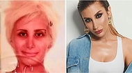 İrem Derici'den Cristiano Ronaldo'ya Estetik Yaptırdıktan Sonra Bambaşka Birine Dönüşen Ünlüler