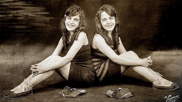 Siyam İkizleri olarak bilinen Daisy ve Violet Hilton, 20. yüzyılın başlarında İngiltere'de dünyaya gelmiş yapışık ikiz kardeşler.