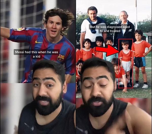 Dünyaca ünlü futbolcu Lionel Messi de çocukluğunda bu hastalıktan muzdaripmiş!