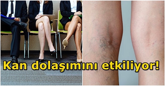 Sürekli Bacak Bacak Üstüne Atarak Oturan İnsanların Vücudunda Neler Olur?