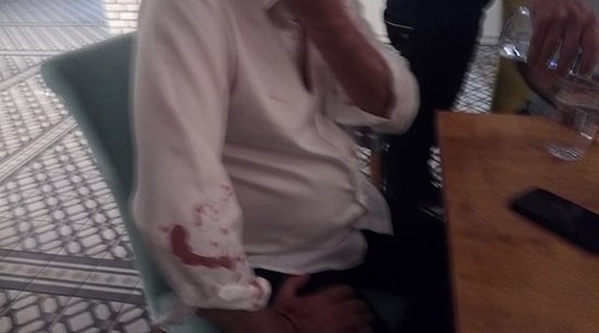 Özışık Kardeşlerin Hedefindeki Didim Belediye Başkanı Atabay'a Beyzbol Sopalı Saldırı