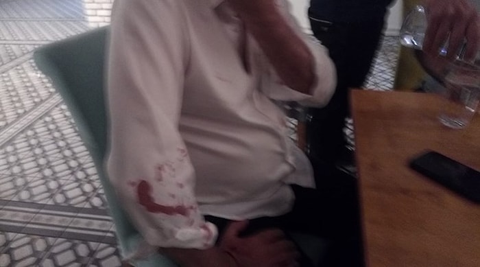 Özışık Kardeşlerin Hedefindeki Didim Belediye Başkanı Atabay'a Beyzbol Sopalı Saldırı