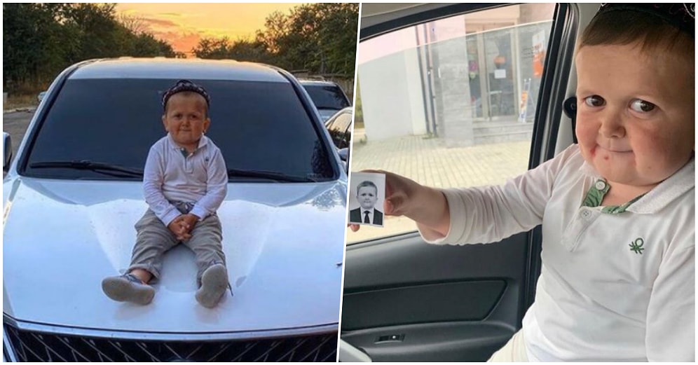 Messi’de de Varmış! Sosyal Medyada Adını Sıklıkla Duyduğumuz Hasbulla’nın Sahip Olduğu Hastalık