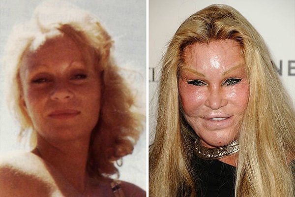 1. Jocelyn Wildenstein