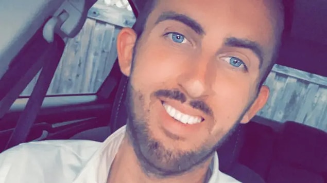 Wesley Prosser, ABD'nin Kaliforniya eyaletinde yaşayan 26 yaşında bir otomobil satıcısı. Kendisi beyninin şişmesine sebep olan ölümcül bir beyin iltihabı atlatmış!