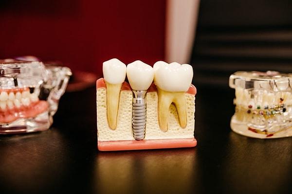 5. "Diş enfeksiyonları da düşünülenin aksine çok ölümcül."