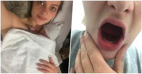 Hamilelik Döneminde Aşırı Kustuğu İçin Bütün Dişlerini Çektirmek Zorunda Kalan Talihsiz Kadın