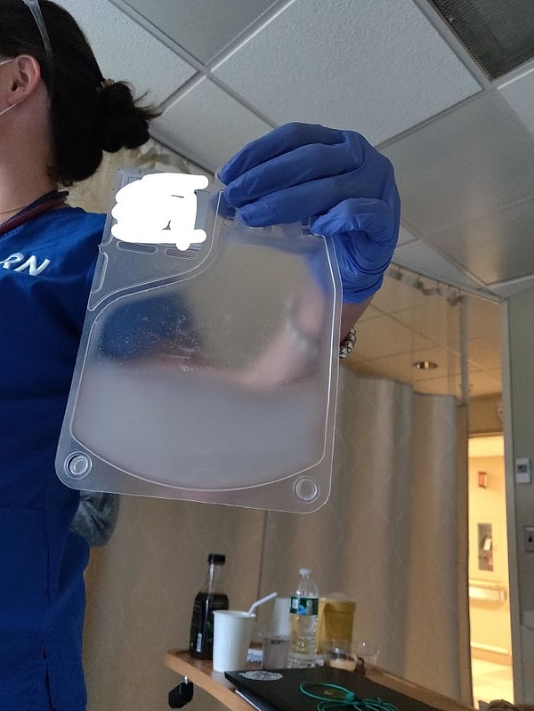 4. Удаленные и генетически модифицированные белые кровяные тельца, которые собираются вернуть, чтобы вылечить рак