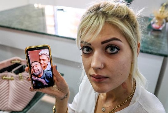 Cezaevinde Yapacağı İşkenceleri Anlatıyormuş: Tabanca ile Boynundan Vurulan Zeliha Atlar'dan Yardım Çağrısı