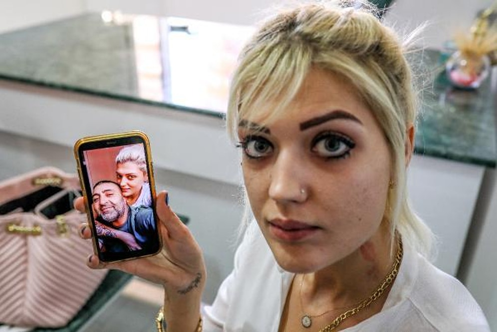 Cezaevinde Yapacağı İşkenceleri Anlatıyormuş: Tabanca ile Boynundan Vurulan Zeliha Atlar'dan Yardım Çağrısı