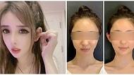 Kepçe Kulaklıyım Diye Üzülmeyin: Asya'da Kepçe Kulak Yaptırma Estetiği Giderek Popülerleşiyor