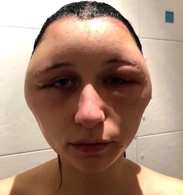 12. Не зря на коробке от краски пишет, что нужно проверять ее на небольшой части волос, прежде чем полностью наносить на голову