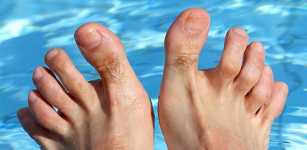 Kusura bakma ama sen biraz çirkin ayaklara sahipsin!