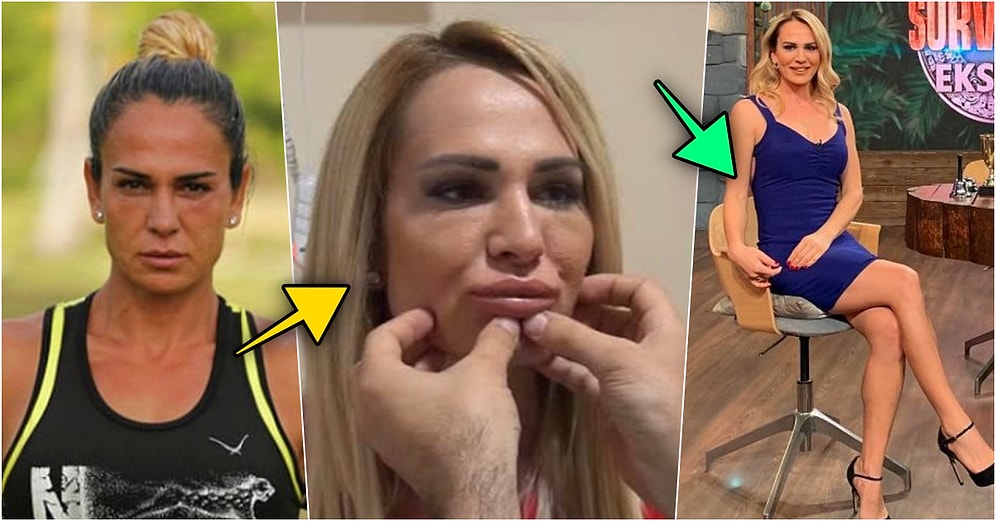 Yaptığı Cinsel İlişki İtirafından Sonra Gündeme Bomba Gibi Düşen Nagihan Karadere’nin İnanılmaz Değişimi