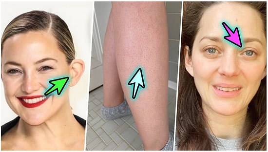 Kadınların Yıllarca Güzellik Standartları Yüzünden Utanıp Sıkıldığı Ama Gayet Normal ve Güzel Olan 12 Özellik