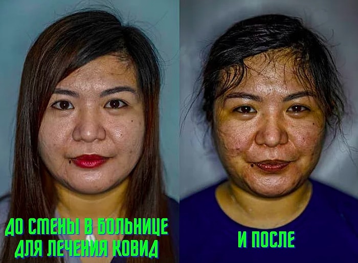 10 удивительных снимков в стиле "до и после", которые заставят вас глубоко вздохнуть