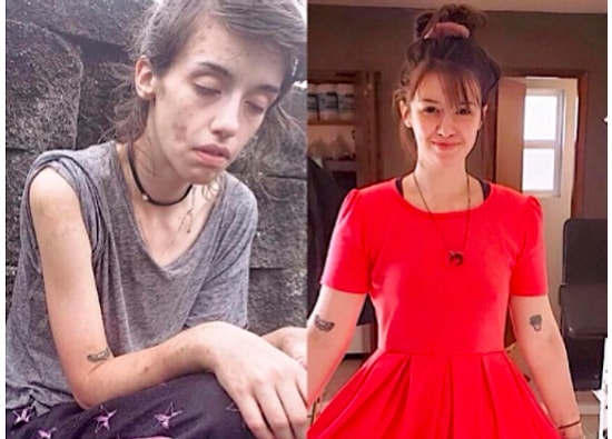 15 удивительных снимков в стиле "до и после", которые заставят вас глубоко вздохнуть