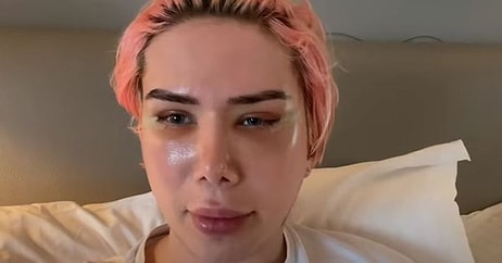 Британский блогер сделал пластическую операцию, чтобы сменить расу и стать корейцем