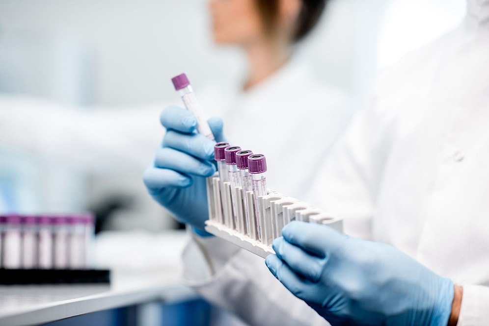 Üçlü Tarama Testi Nedir? Üçlü Test İle Hangi Hastalıklar Tespit Edilebilir?