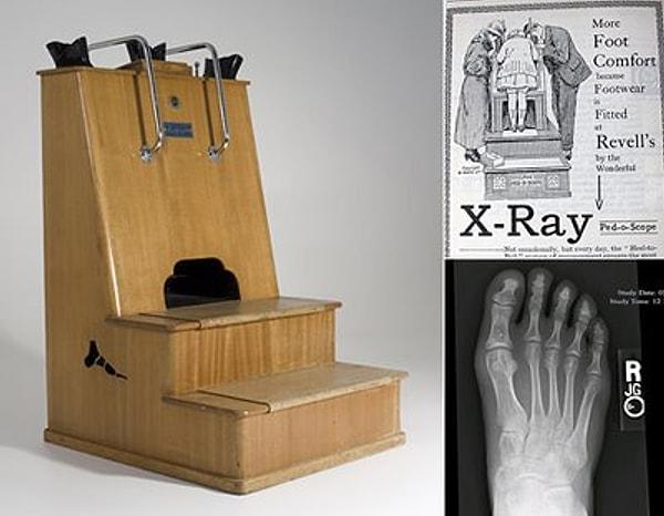 5. Ayakkabı mağazaları, X-ışınlarının riskleri keşfedilmeden önce, 1940'larda ayakkabının olup olmayacağını anlamak için X-Ray makineleri kullanıyordu.