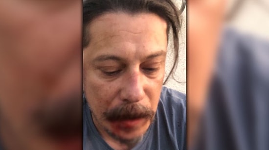 Gazeteci Erk Acarer Saldırıya Uğradı