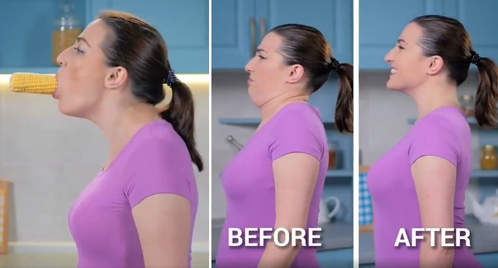 Bu Taktik Çok Konuşulur: Gıdı Probleminden Ameliyatsız Kurtulmak İsteyenlere 'Mısır' Taktiği