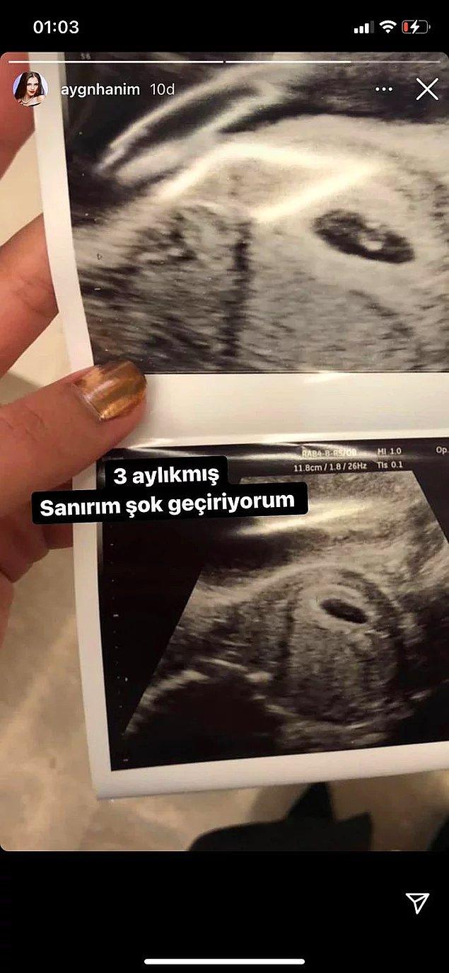 En sonunda da hamile olduğunu iddia ettiği ultrason görüntülerini paylaşmıştı bizlerle. Ancak bu görüntüler de sahte çıkmıştı.