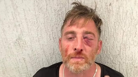 Gürcistan'da LGBTİ+ Karşıtlarının Yaraladığı Kameraman Hayatını Kaybetti