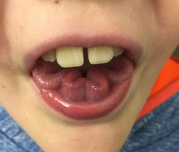 15. 83,7% людей умеют вращать языком, но только 14,7% людей могут сделать из своего языка клевер