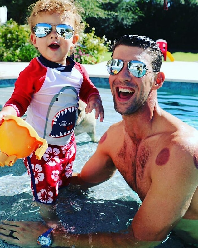 26. Kupa tedavisi alan ünlü yüzücü Michael Phelps: