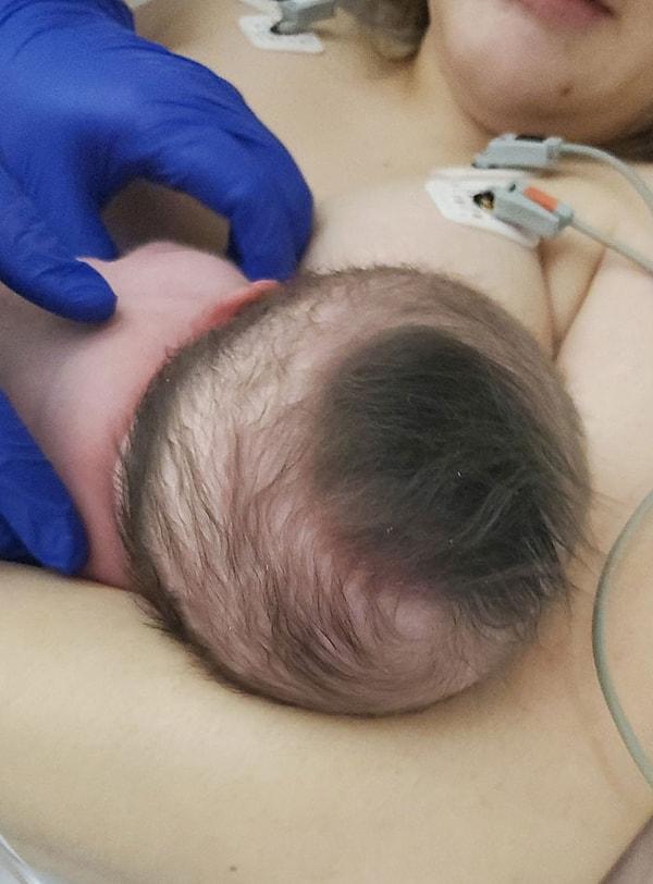 24. "Yeni doğan kızımın başında oldukça kalın bir saç öbeği var."