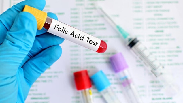 Folik Asit Değerleri Kaç Olmalıdır?