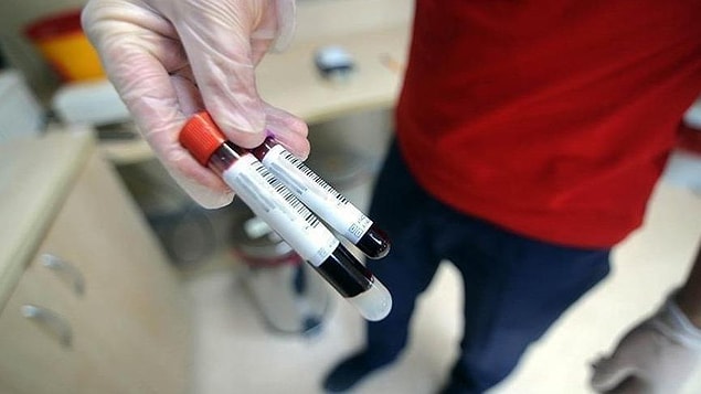 LDL Kolesterol Yüksekliği ve Düşüklüğü Ne Anlamlara Gelmektedir?