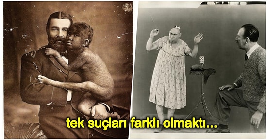 Son Derece Popüler Olan Freak Show’un En Çok Tanınan 5 Kurbanının Trajik Yaşam Öyküsü