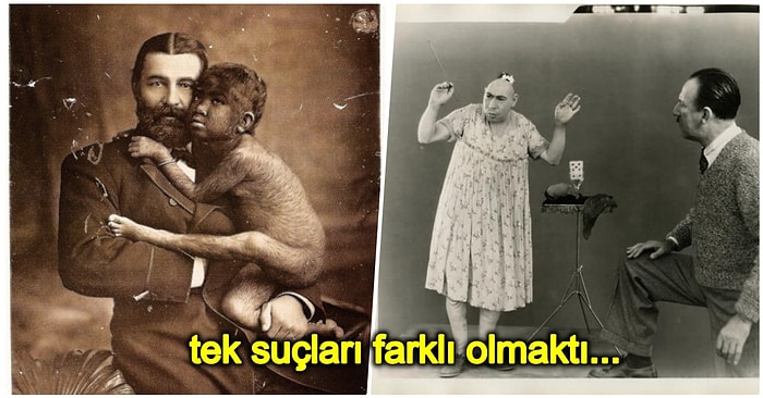 Son Derece Popüler Olan Freak Show’un En Çok Tanınan 5 Kurbanının Trajik Yaşam Öyküsü