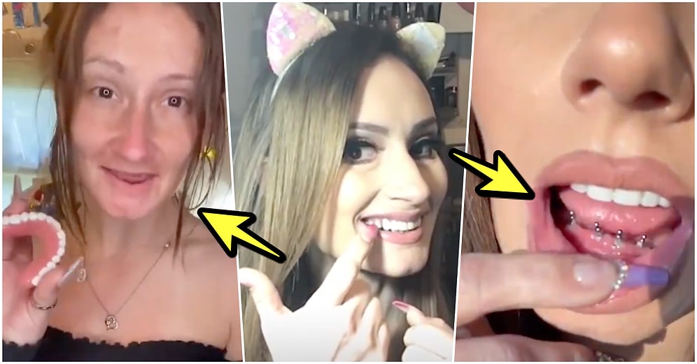 Hamilelikten Sonra Dişlerini Kaybedip Hayatına Takma Dişle Devam Eden Kadının Bi' Acayip Hikayesi