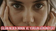 Toplanın! Donuk ve Yorgun Görünen Cildin 10 Yaygın Nedenini Söylüyoruz