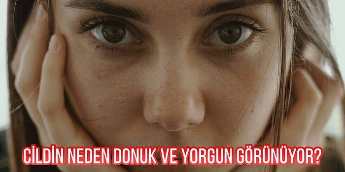 Toplanın! Donuk ve Yorgun Görünen Cildin 10 Yaygın Nedenini Söylüyoruz