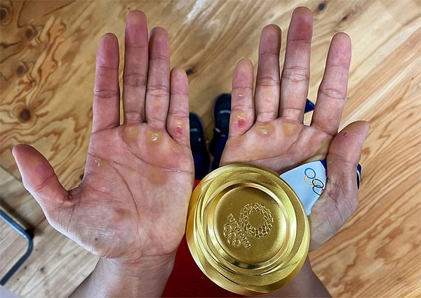 20. Руки Хидилин Диас после завоевания первой Олимпийской золотой медали своей страны