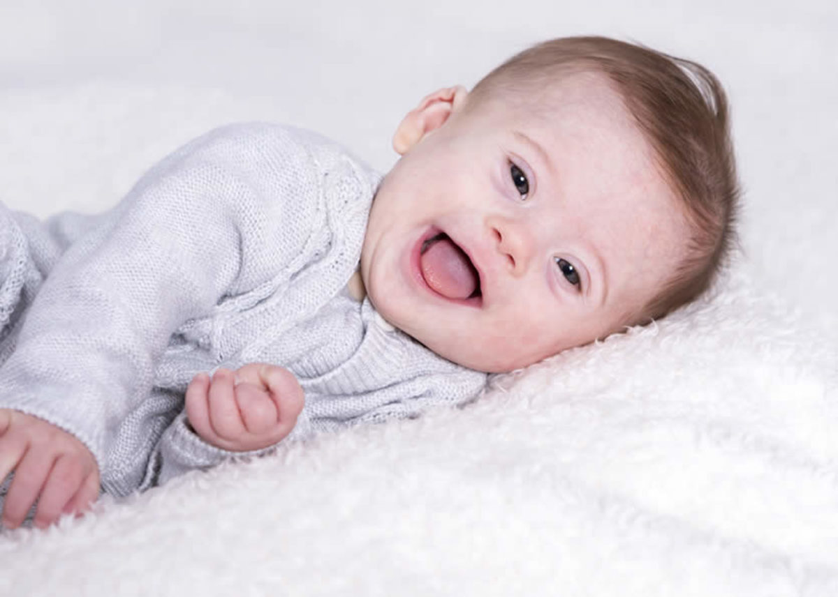 Down Sendromu Belirtileri Nelerdir?