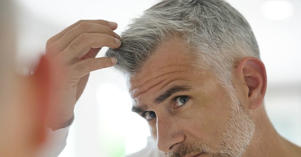 5. Olmazsa olmaz soru gelsin! Ailende genetik olarak saç dökülmesi var mı?