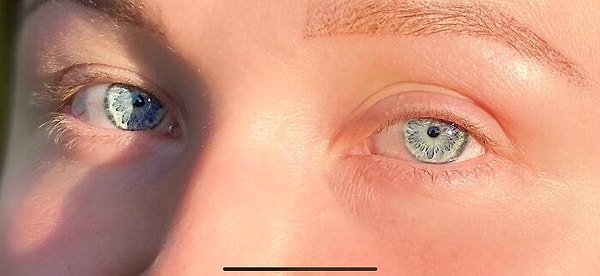 5. Этот необычный "узор" в глазах
