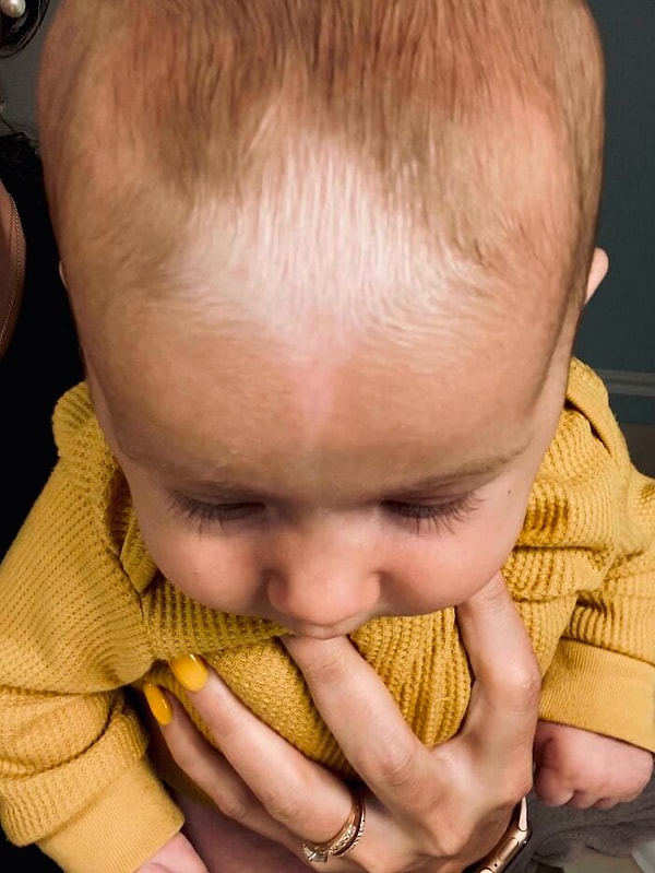 12. Родимое пятно у моей дочери