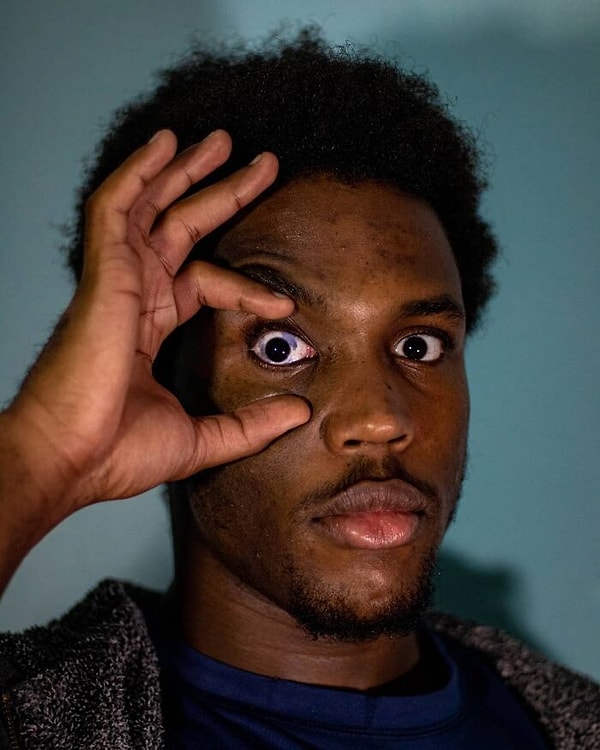 13. У меня родинка в глазу