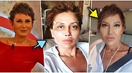Fransız Askısı Dahil Yaptırdığı Estetiklerle Bambaşka Birine Dönüşen Serap Paköz'ün Son Hali Herkesi Şaşırttı!