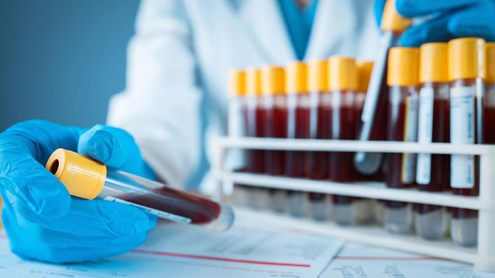 Lipaz Nedir? Yüksekliği ve Düşüklüğü Ne Anlama Gelir? Değerleri Kaç Olmalıdır?